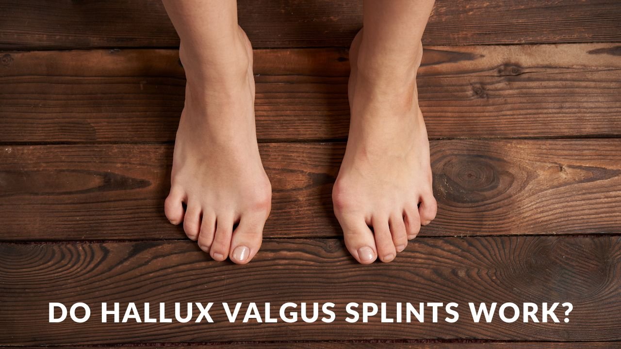 Hallux Valgus Splints: Do They Work?