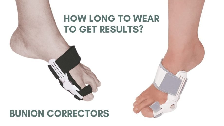 How Long Should You Wear A Bunion Corrector