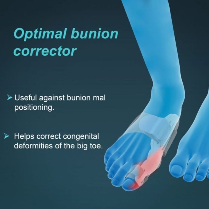 tynor bunion splint uses